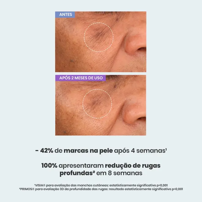 Sallve Sérum Antissinais – 30 g