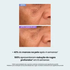 Sallve Sérum Antissinais – 30 g